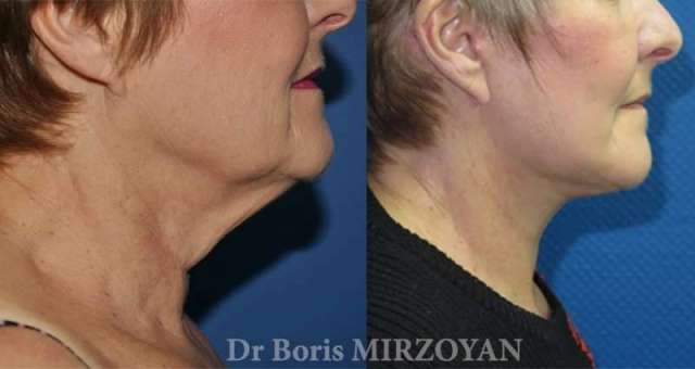 83054197_708701263197173_880171996856823852_n