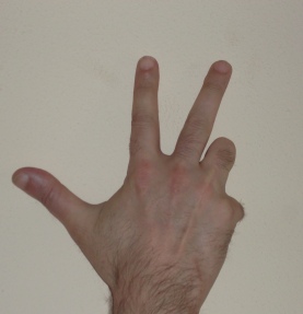 Комбинация из трех пальцев или Артур Багдасарян: выбор за вами 