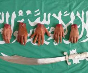 В Иране вору публично отсекли пальцы