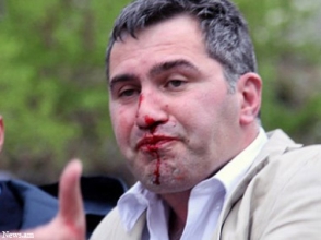 Արմեն Մարտիրոսյանին ոստիկական մեքենայում նկարողը հանրապետությունում չէ. ոստիկանության պարզաբանումը