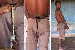 Индийца, у которого вырос хвост, признали божеством