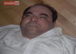 В соцсетях появились сенсационные фотографии тела Зураба Жвании (видео)