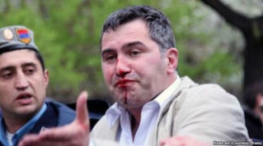 Արմեն Մարտիրոսյանի դեմքին ոտքով հարվածող ոստիկանը արտագաղթել է