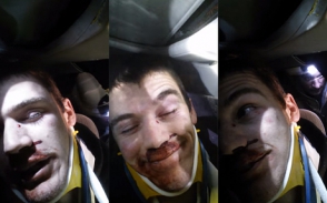 ՃՏՊ–ի ամենահանդարտ տուժածը