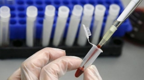 Արցախում 63 հիվանդի մոտ ախտորոշվել է թոքաբորբ