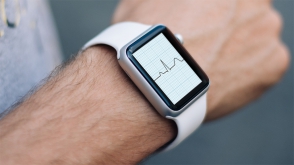«Apple Watch»-ի միջոցով հնարավոր կլինի ախտորոշել սրտի հնարավոր կաթվածը