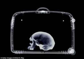 Գերմանացի գիտնականի ճամպրուկում մարդու գանգ են հայտնաբերել