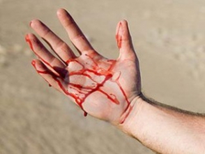 Մորը կացնահարած դուստրը հաշվառված է «Շիզոֆրենիա,  պարանոիդ ձև» ախտորոշմամբ