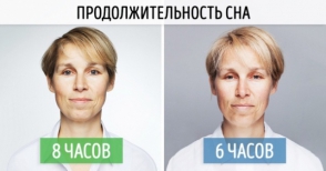 Հետազոտություն, որը ցույց է տալիս, թե ինչ կարող է պատահել քնի խանգարման ընթացքում (լուսանկար)