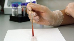 Обычный анализ крови позволит определить дату смерти человека