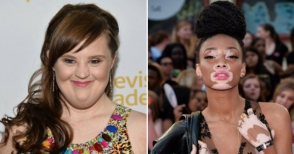 Այս կանայք ապացուցել են, որ գեղեցկությունը սահմաններ չունի (ֆոտոշարք)