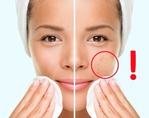 5 հրաշալի հնարք, որի համար ձեր մաշկը ձեզ շնորհակալություն կասի (ֆոտոշարք)