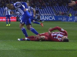 Фернандо Торрес получил серьезную травму головы в матче с «Депортиво» (видео)