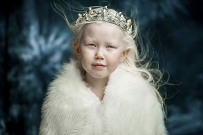 8-ամյա ալբինոս այս աղջնակին սիբիրյան «Սպիտակաձյունիկ» են անվանում (ֆոտոշարք)