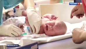 Վիրաբույժները փրկել են կես սրտով ծնված փոքրիկի կյանքը (տեսանյութ)