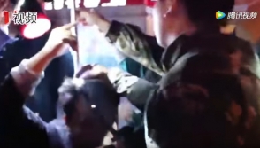 Չինացու գանգի մեջ 1 մետրանոց մետաղական ձող է մտել, բայց նա կենդանի է մնացել (տեսանյութ)