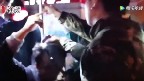 Չինացու գանգի մեջ 1 մետրանոց մետաղական ձող է մտել, բայց նա կենդանի է մնացել (տեսանյութ)