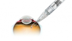 Создан глазной имплант, который предотвращает слепоту