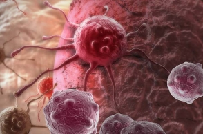 Ученые назвали основные признаки рака