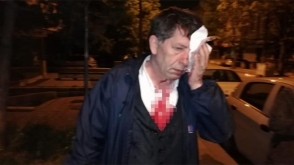 Թուրք լրագրող Յավուզ Դեմիրաղը մահակներով ծեծի է ենթարկվել