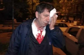 Դաժան ծեծի ենթարկված ընդդիմադիր լրագրողն Էրդողանին վիրավորելու համար կազատազրկվի