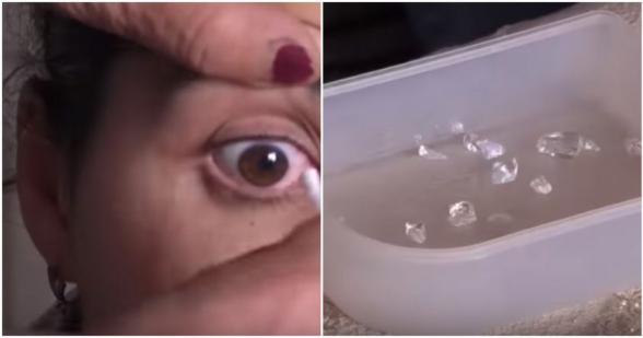 Շիրակի մարզի Սպանդարյան գյուղում ապրող երիտասարդ կնոջ աչքերից բյուրեղներ են թափվում