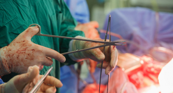 Սարսափելի անոմալիա․ Հնդկաստանում 4 ոտքով, 3 ձեռքով աղջիկ է ծնվել