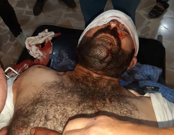 Քամիշլոյում ողջ գիշեր իրականացվել է սպանդ (տեսանյութ, լուսանկար)