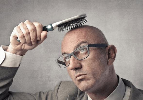 Հետազոտողները տղամարդկանց ճաղատանալու անսպասելի պատճառ են նշել