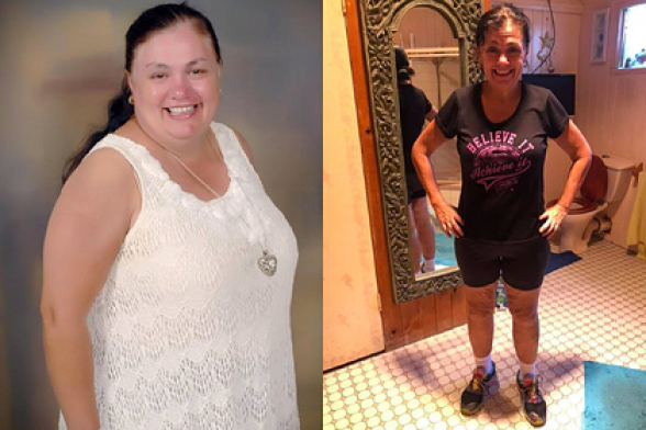 Ленивая женщина нашла способ похудеть на 60 килограммов