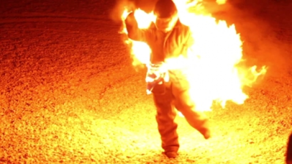 Մարմնի 90 տոկոս այրվածքներով Այրվածքաբանության կենտրոն է տեղափոխվել մի տղամարդ