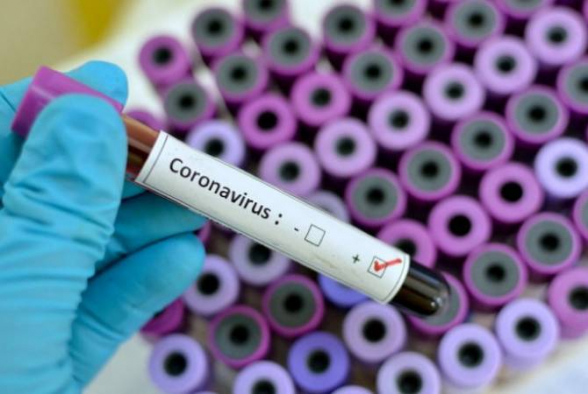 Тесты на коронавирус 2 школьников отрицательные – губернатор Армавира