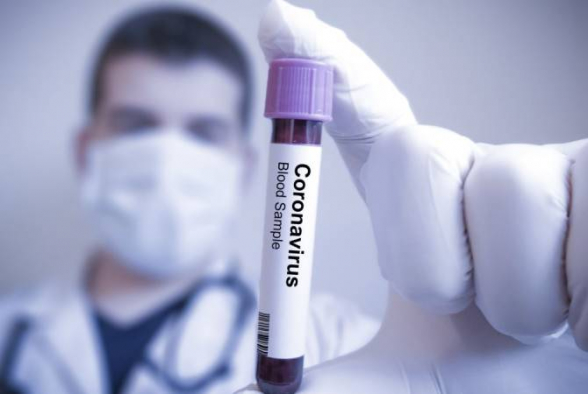 Количество подтвержденных случаев коронавируса в Армении выросло до 84