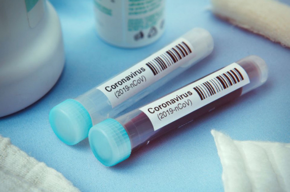 Թուրքիայում մարտի 24-ին կորոնավիրուսից 7 մարդ է մահացել․ ermenihaber