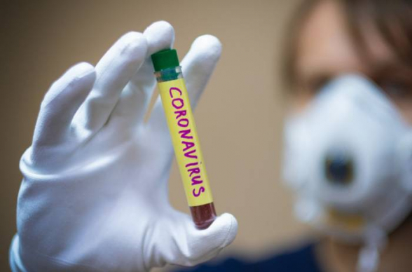 Число заразившихся коронавирусом в России возросло до 840