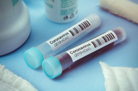 В Азербайджане выявлено 29 новых случаев заражения коронавирусом