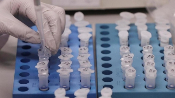 Россия передала Азербайджану 70 наборов тест-систем для COVID-19