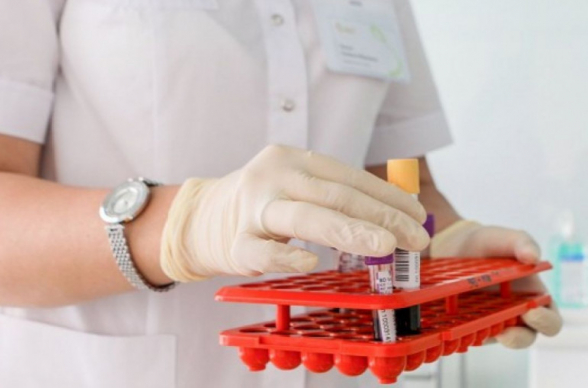 532 վարակված․ հրապարակվել են նոր տվյալներ