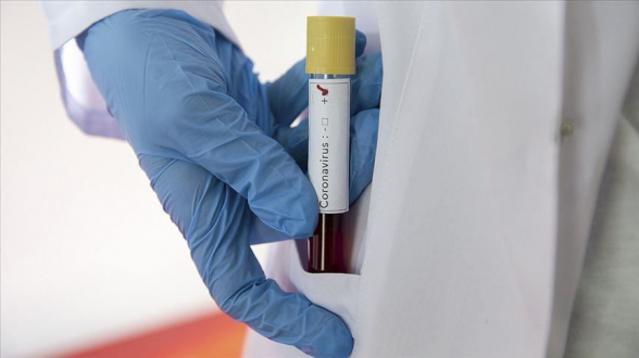 Հայաստանում կորոնավիրուսային հիվանդության հաստատված դեպքերն` ըստ Երևանի և մարզերի