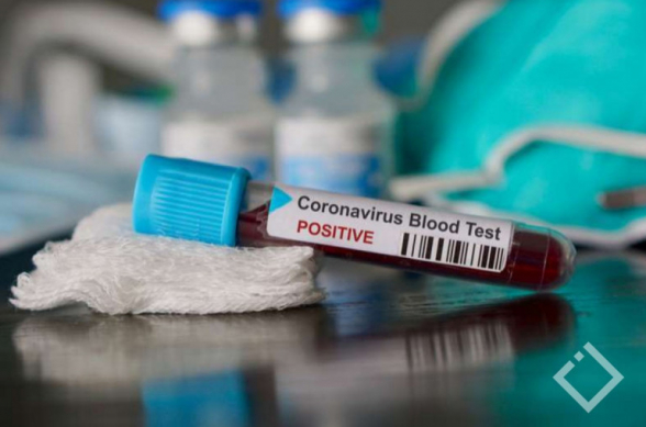 В Азербайджане число инфицированных COVID-19 достигло 641