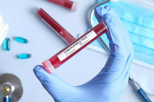 Կորոնավիրուսից 80-ամյա տղամարդ է մահացել