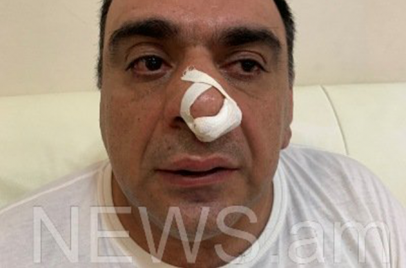 Մոսկվաբնակ գործարար Օնիկ Կարապետյանին Խաչատուր Սուքիասյանի եղբոր կողմից ծեծի ենթարկելուց հետո դեռևս քրեական գործ չի հարուցվել, նա որպես տուժող չի ճանաչվել. պաշտպան