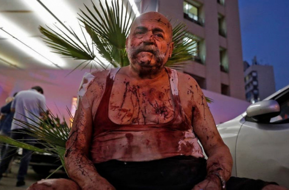 Число жертв взрыва в Бейруте достигло 78, более 4 тыс. ранены (видео)