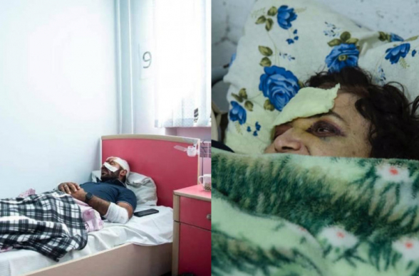 Շոշ գյուղի հրթիռակոծության հետևանքով վիրավորվել են 36-ամյա Սողոմոն Մելքումյանը և 70-ամյա Էլմիրա Թորոսյանը․ Տեղեկատվական շտաբ