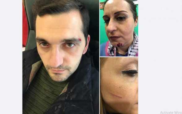 Требующие отставки Пашиняна и мойшаговцев участники акции подверглись нападению – «Mediaport» (фото, видео)