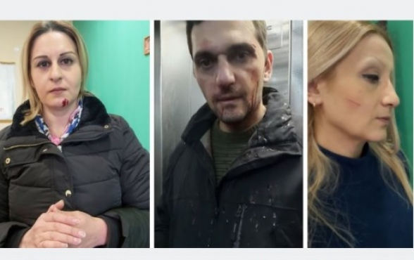 «Իմ քայլ»-ի պատգամավոր Կորյուն Մկրտչանի տան մոտ բողոքի ակցիա իրականացնող քաղաքացիներին ծեծի ենթարկելու կադրերը