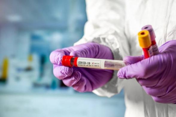 12 մահ՝ 1 օրում․ կորոնավիրուսով վարակվելու 242 նոր դեպք է արձանագրվել Հայաստանում