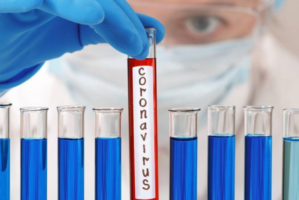 За сутки в Армении выявлен 491 новый случай COVID-19, скончались еще 7 человек