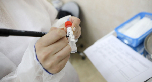 Հայաստանում արդեն կորոնավիրուսի բրիտանական շտամ կա. նախարարություն