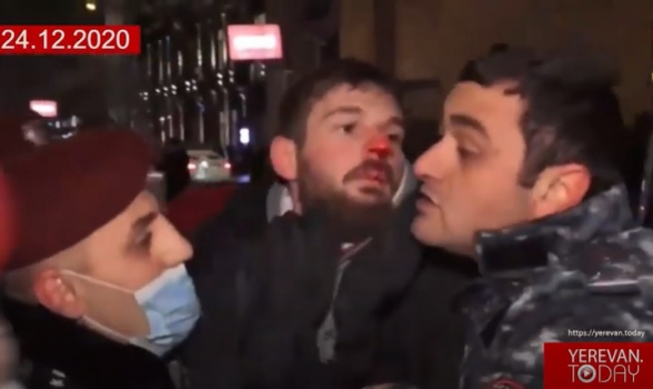 Ինչպե՞ս են ցրում ցույցերը իմքայլականի ասած ժողովրդավարության բաստիոնում (տեսանյութ)